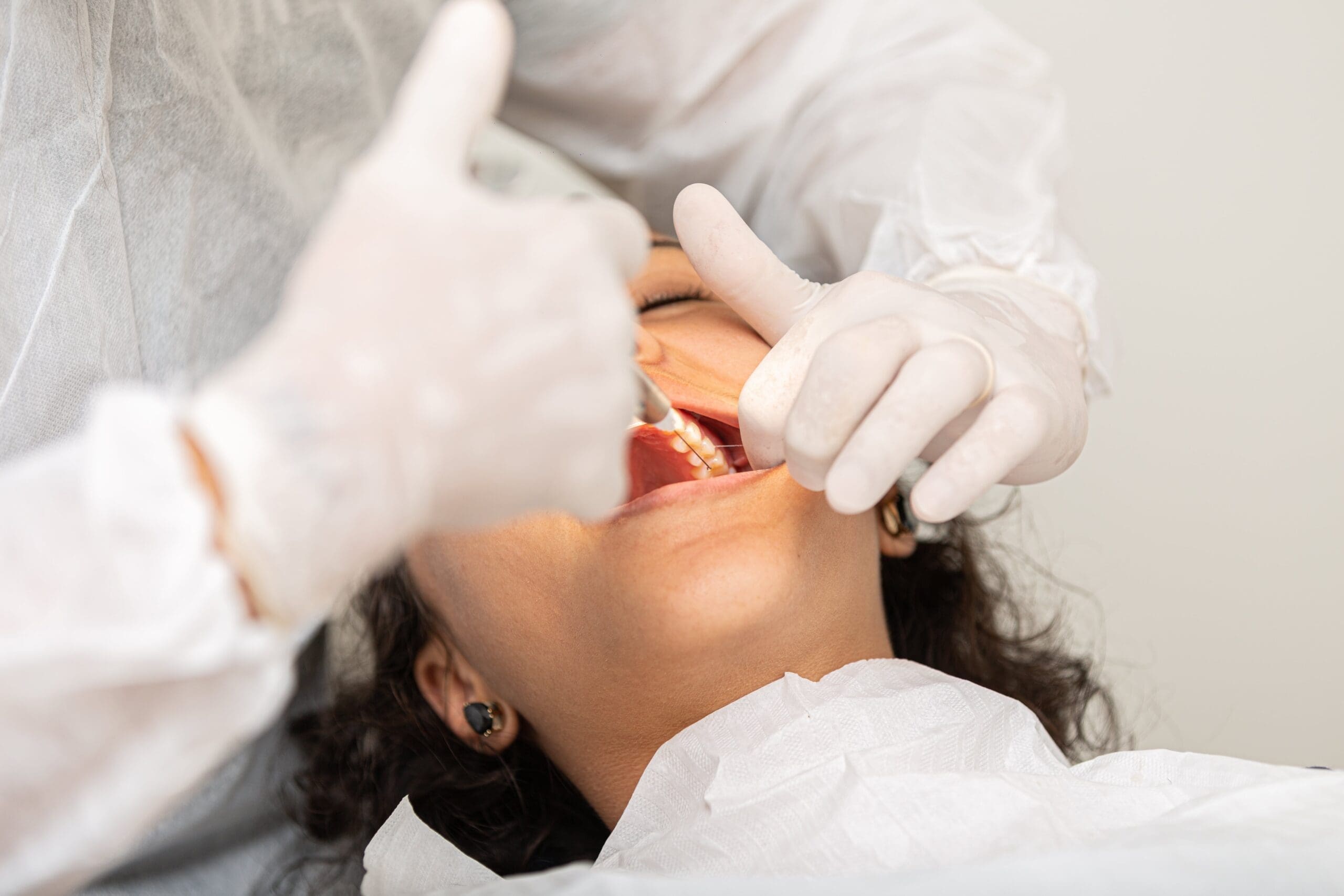 surgical wisdom tooth removal price surgical wisdom tooth removal price