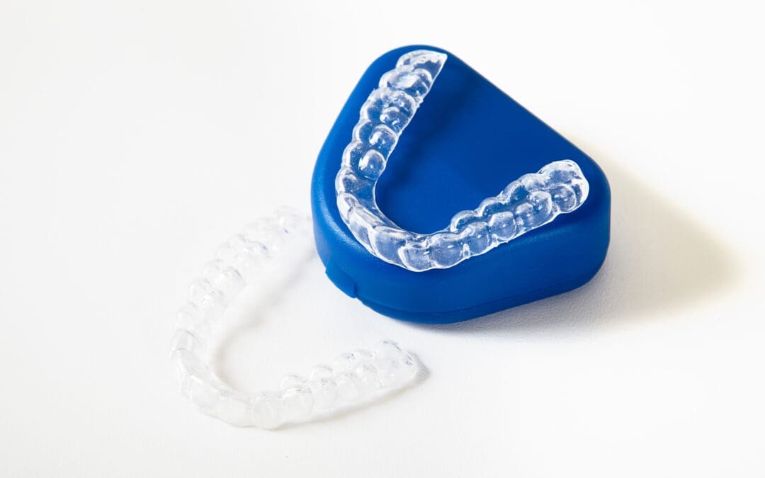 Invisible Braces in Australia: Types, Benefits and How They Compare to Traditional Braces